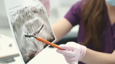 Chairside care at Akron Family Dental